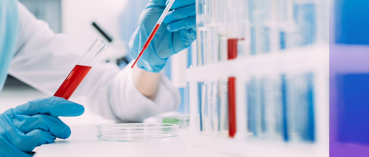 最新研究丨华西医院：对太阳成集团tyc122ccvipDLCM技术平台检测ANCA相关血管炎的诊断评价