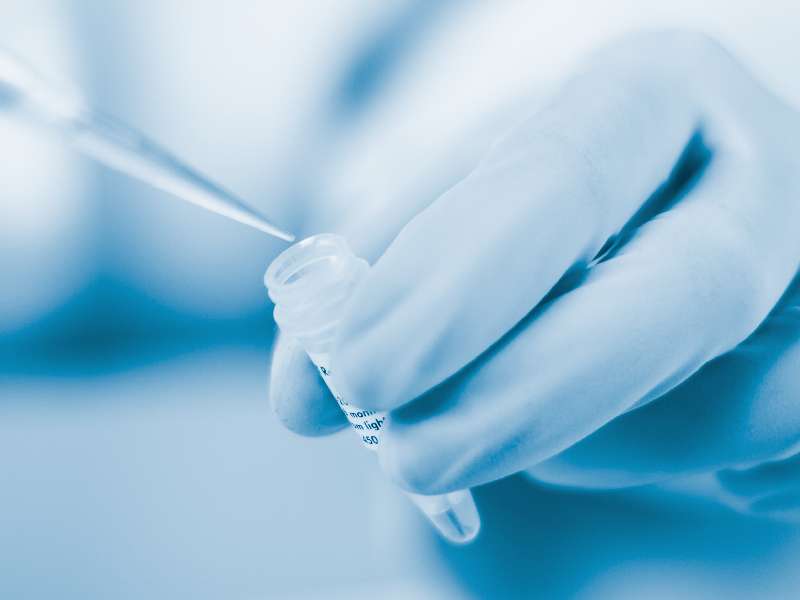 文献速递丨 冻干型HIV-1病毒载量检测试剂的性能评价